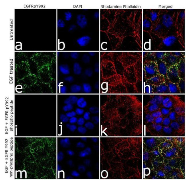 Phospho-EGFR (Tyr992) Antibody in Immunocytochemistry (ICC/IF)