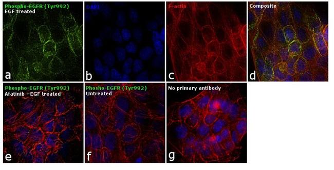 Phospho-EGFR (Tyr992) Antibody