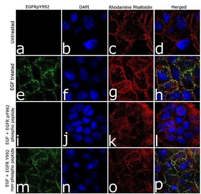 Phospho-EGFR (Tyr992) Antibody