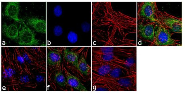 Phospho-MYL9 (Thr18, Ser19) Antibody in Immunocytochemistry (ICC/IF)