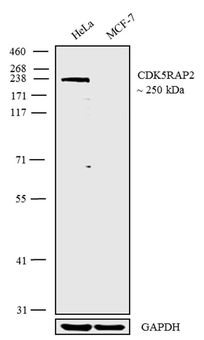 CDK5RAP2 Antibody in Western Blot (WB)