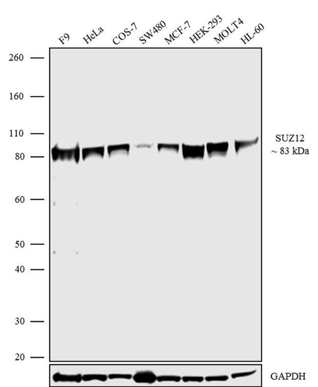 SUZ12 Recombinant Rabbit Monoclonal Antibody (7H26L21)