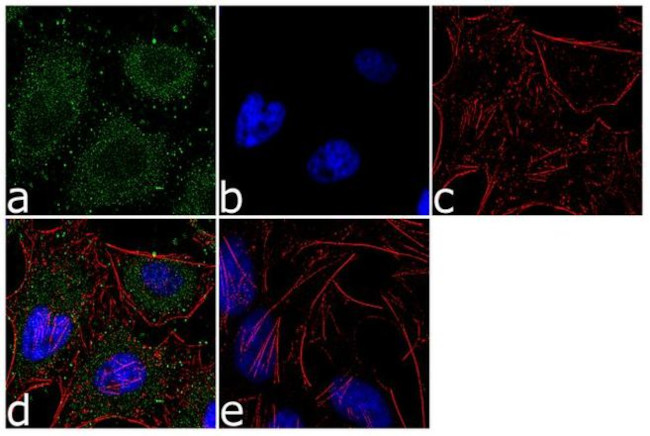 ALDH1L1 Antibody in Immunocytochemistry (ICC/IF)