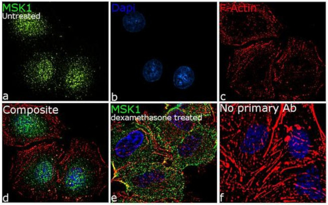 MSK1 Antibody in Immunocytochemistry (ICC/IF)