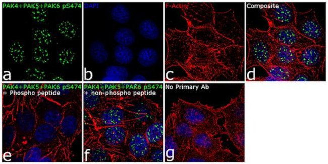 Phospho-PAK4/6/7 (Ser474) Antibody in Immunocytochemistry (ICC/IF)