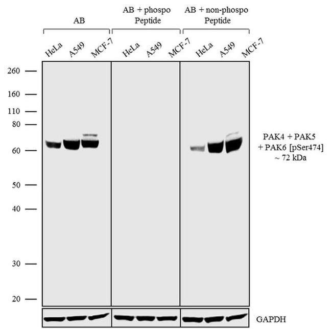 Phospho-PAK4/6/7 (Ser474) Antibody in Western Blot (WB)