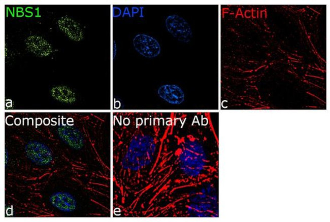 NBS1 Antibody in Immunocytochemistry (ICC/IF)