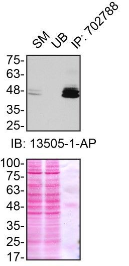 Ataxin 3 Antibody in Immunoprecipitation (IP)