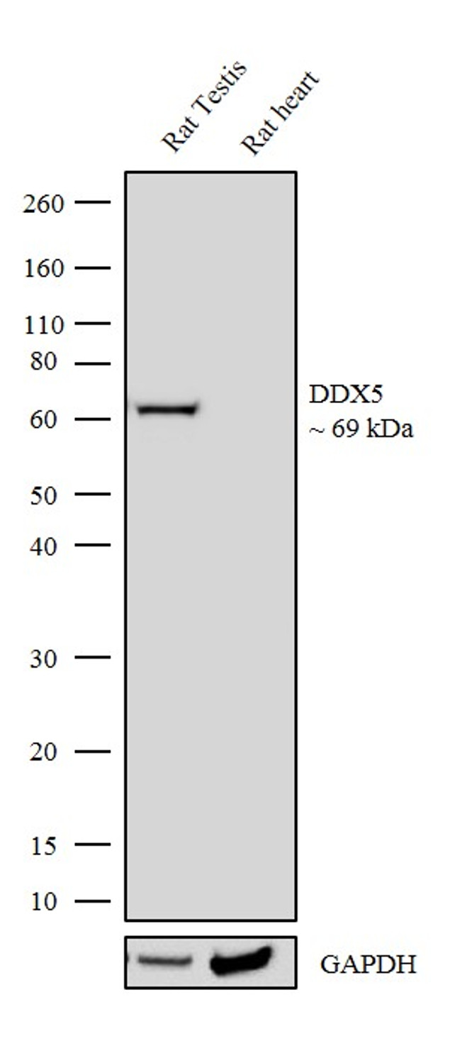 DDX5 Antibody