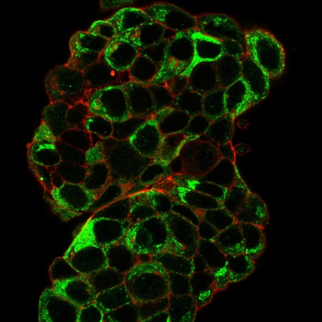 pS2/pNR-2/TFF1 (Estrogen-Regulated Protein) Antibody in Immunocytochemistry (ICC/IF)