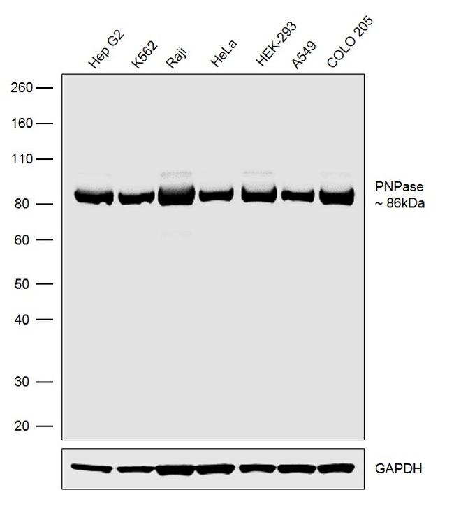 PNPase Antibody in Western Blot (WB)