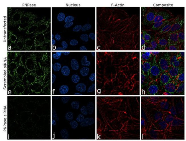 PNPase Antibody