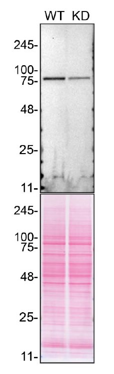 DDX1 Antibody in Western Blot (WB)