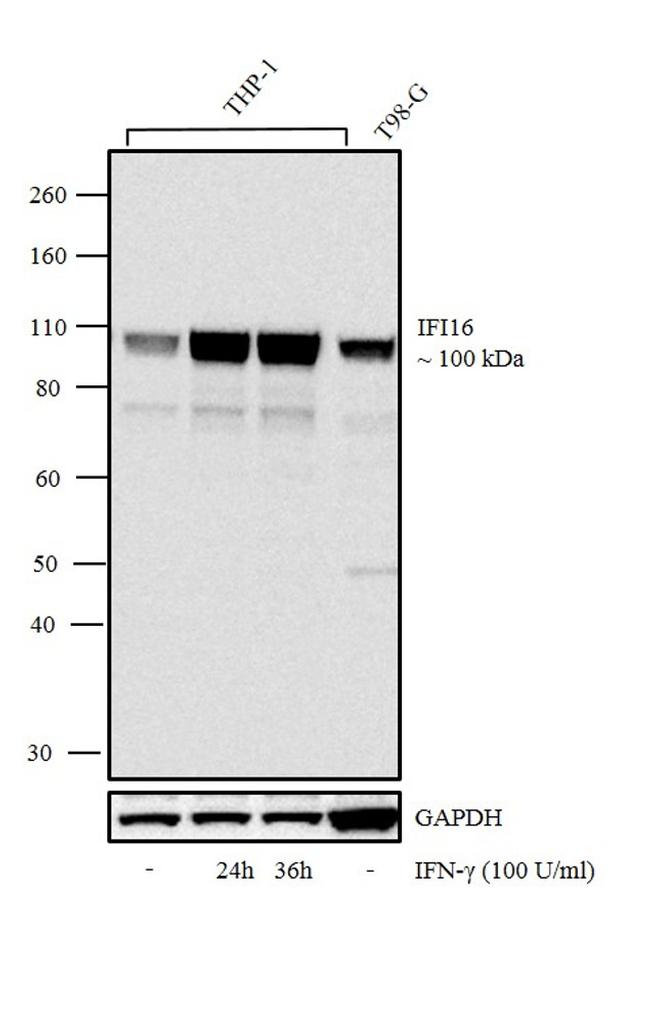 IFI16 Recombinant Monoclonal Antibody (8H37L1) (703147)