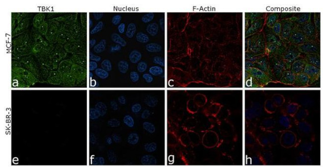 TBK1 Antibody in Immunocytochemistry (ICC/IF)