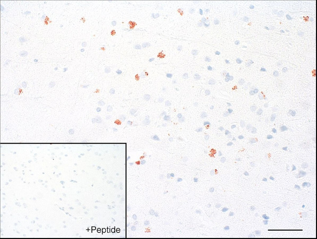 GPR98 Antibody in Immunohistochemistry (IHC)