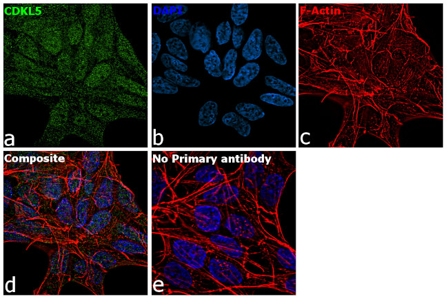 CDKL5 Antibody in Immunocytochemistry (ICC/IF)