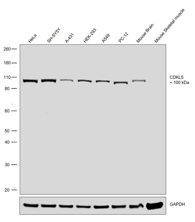 CDKL5 Antibody in Western Blot (WB)