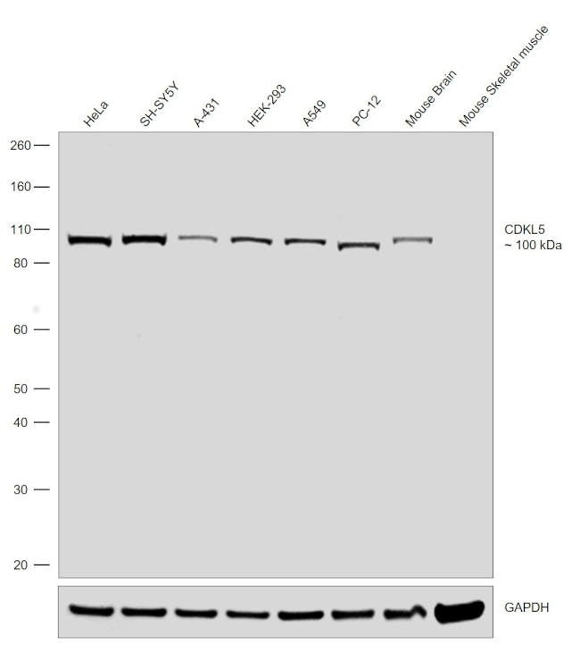 CDKL5 Antibody