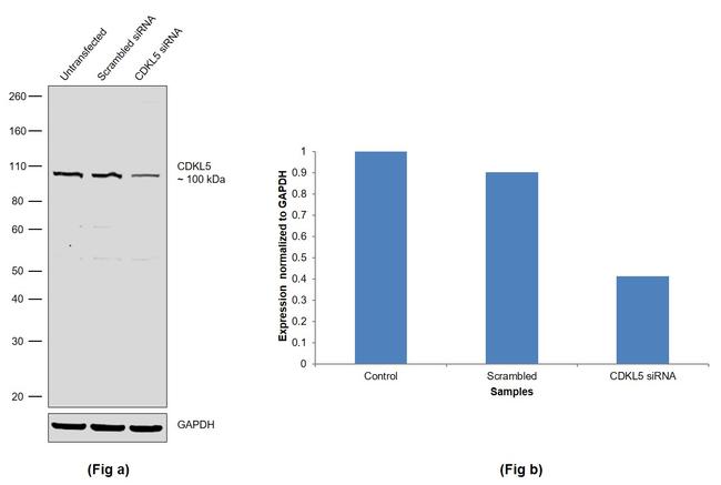 CDKL5 Antibody in Western Blot (WB)