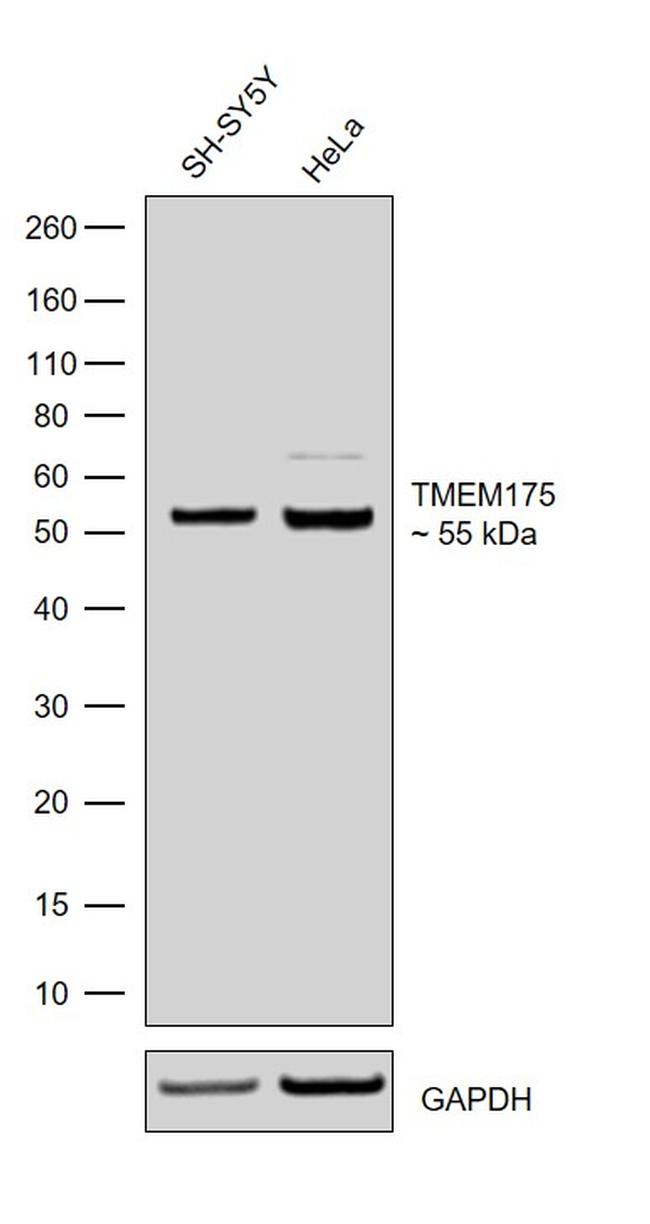 TMEM175 Recombinant Monoclonal Antibody (5H18L65) (703805)