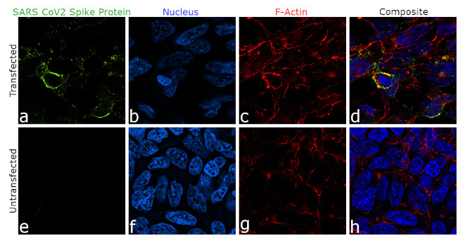 SARS-CoV-2 Spike Protein (RBD) Chimeric Antibody in Immunocytochemistry (ICC/IF)