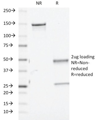 TGF-beta (Transforming Growth Factor beta) Antibody in SDS-PAGE (SDS-PAGE)