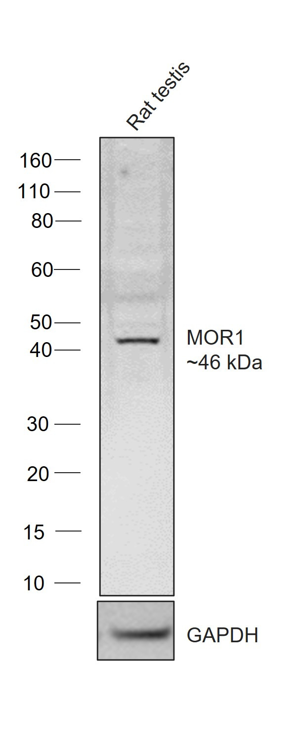 OPRM1 Antibody in Western Blot (WB)