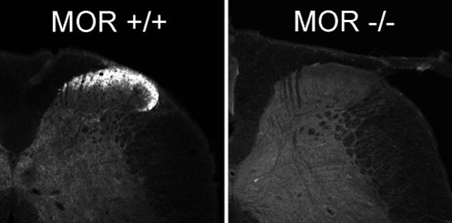 OPRM1 Antibody in Immunohistochemistry (IHC)