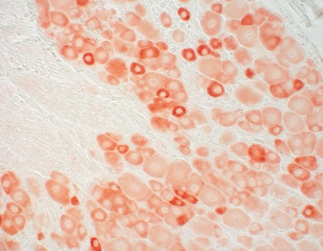 OPRM1 Antibody in Immunohistochemistry (IHC)