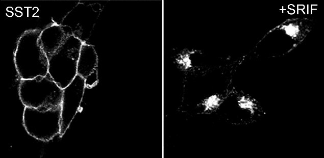 SSTR2 Antibody in Immunocytochemistry (ICC/IF)