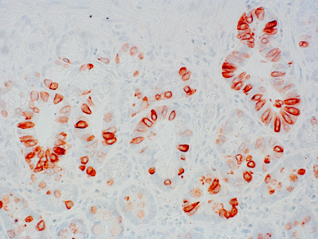 SSTR2 Antibody in Immunohistochemistry (IHC)