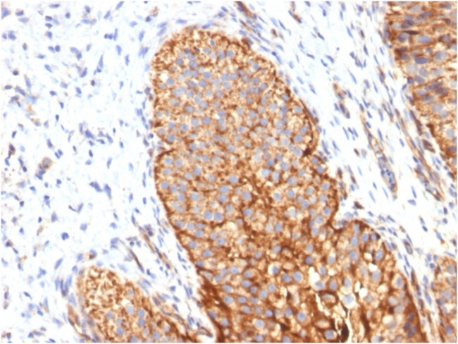 Thrombomodulin/CD141 Antibody in Immunohistochemistry (Paraffin) (IHC (P))