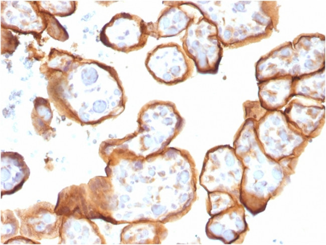 Thrombomodulin/CD141 Antibody in Immunohistochemistry (Paraffin) (IHC (P))