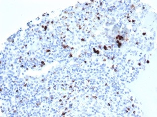 TIA1 (T-Cell-Restricted Intracellular Antigen-1) Antibody in Immunohistochemistry (Paraffin) (IHC (P))