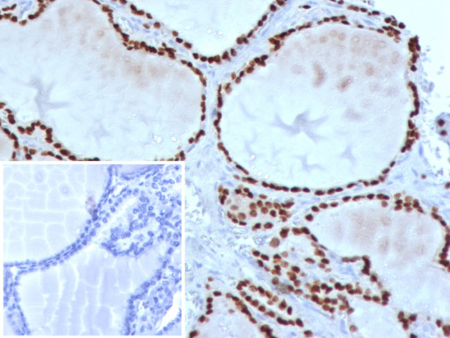 TTF-1/NKX2.1 (Thyroid and Lung Epithelial Marker) Antibody in Immunohistochemistry (Paraffin) (IHC (P))