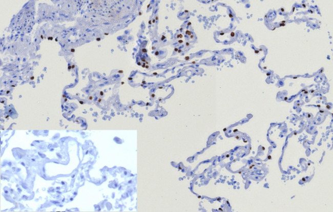 TTF-1/NKX2.1 (Thyroid and Lung Epithelial Marker) Antibody in Immunohistochemistry (Paraffin) (IHC (P))