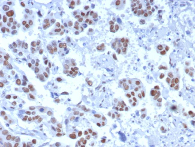 TLE1 (Synovial Sarcoma Marker) Antibody in Immunohistochemistry (Paraffin) (IHC (P))
