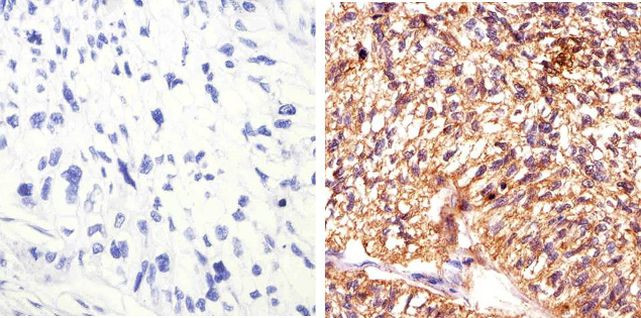 STAT5 alpha Antibody in Immunohistochemistry (Paraffin) (IHC (P))