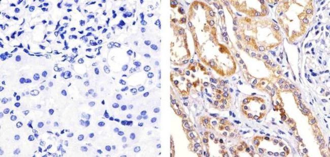 Phospho-p38 MAPK (Thr180, Tyr182) Antibody in Immunohistochemistry (Paraffin) (IHC (P))