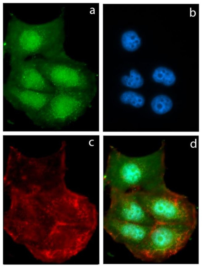 alpha Synuclein Antibody in Immunocytochemistry (ICC/IF)