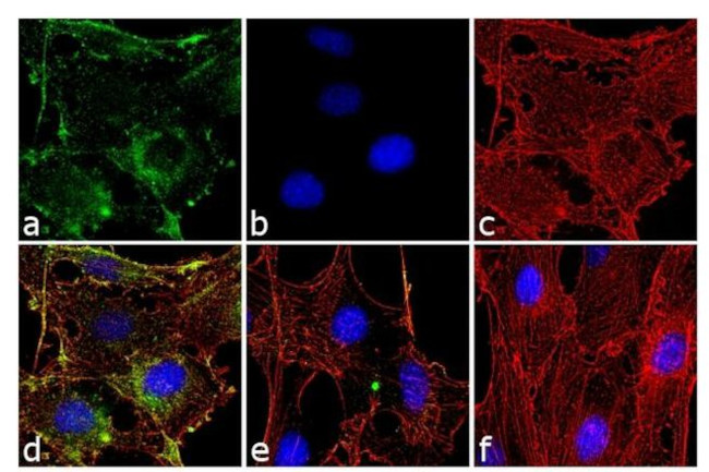 Phospho-AKT1 (Thr308) Antibody in Immunocytochemistry (ICC/IF)