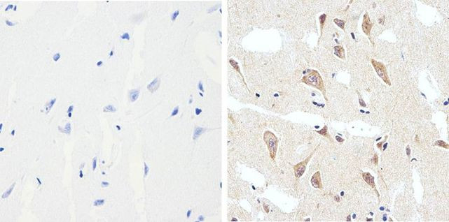 Phospho-Tau (Ser199) Antibody in Immunohistochemistry (Paraffin) (IHC (P))