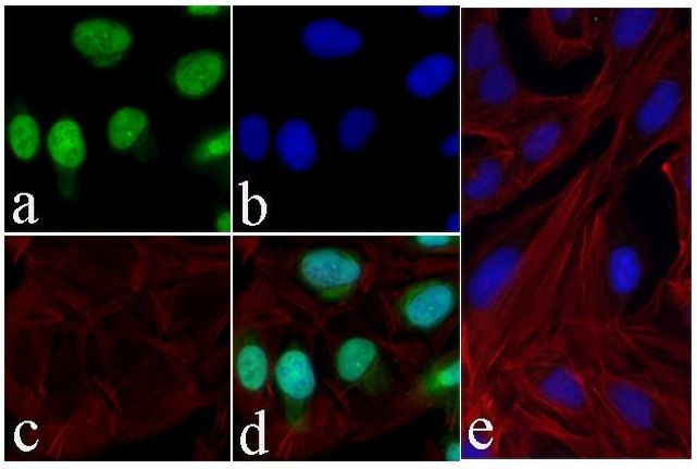 Phospho-Tau (Ser199) Antibody in Immunocytochemistry (ICC/IF)