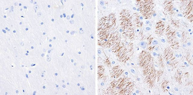 Phospho-Tau (Ser199) Antibody in Immunohistochemistry (Paraffin) (IHC (P))