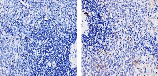 TLR4 Antibody in Immunohistochemistry (Paraffin) (IHC (P))