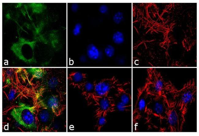 FABP4 Antibody