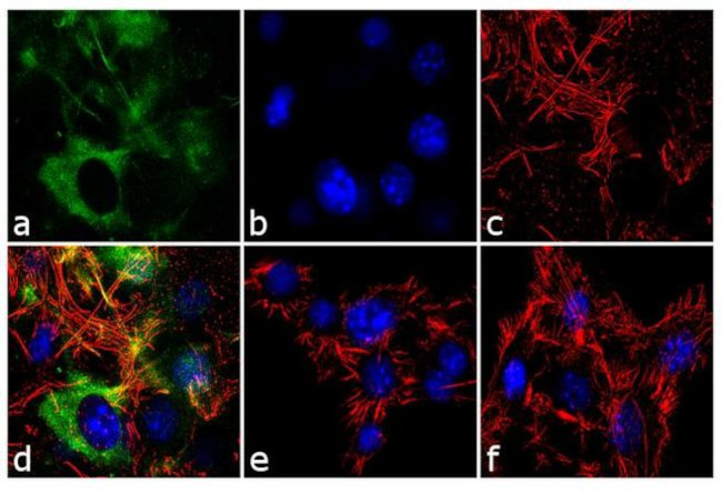 FABP4 Antibody in Immunocytochemistry (ICC/IF)