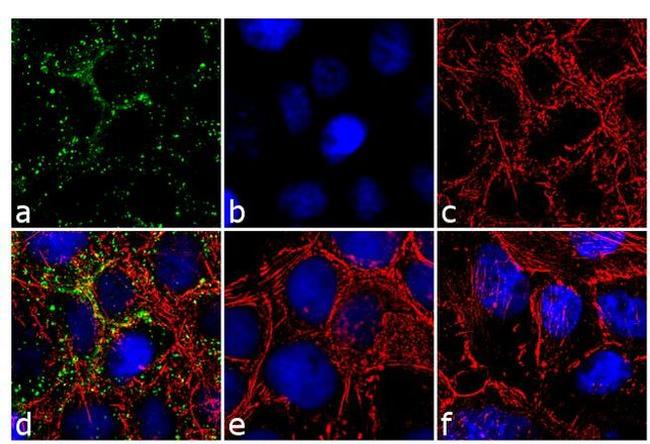 Phospho-EGFR (Tyr1148) Antibody