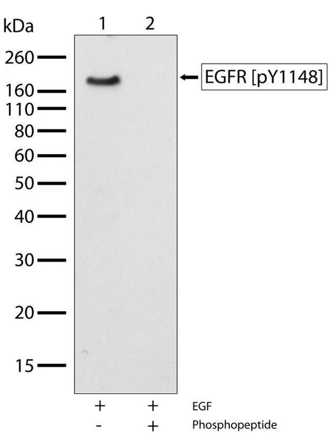 Phospho-EGFR (Tyr1148) Antibody in Western Blot (WB)